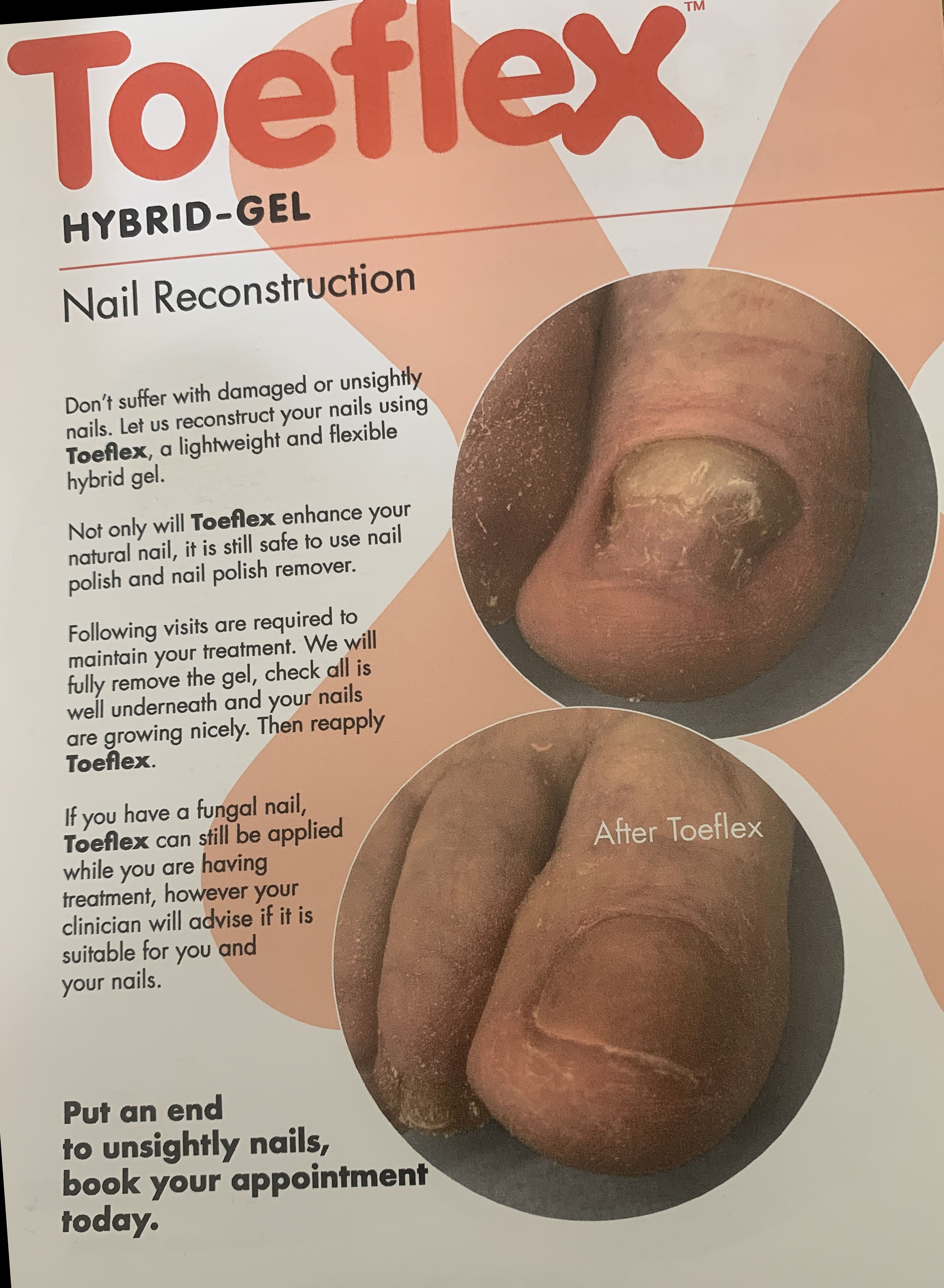 Nail rreconstruction flyer